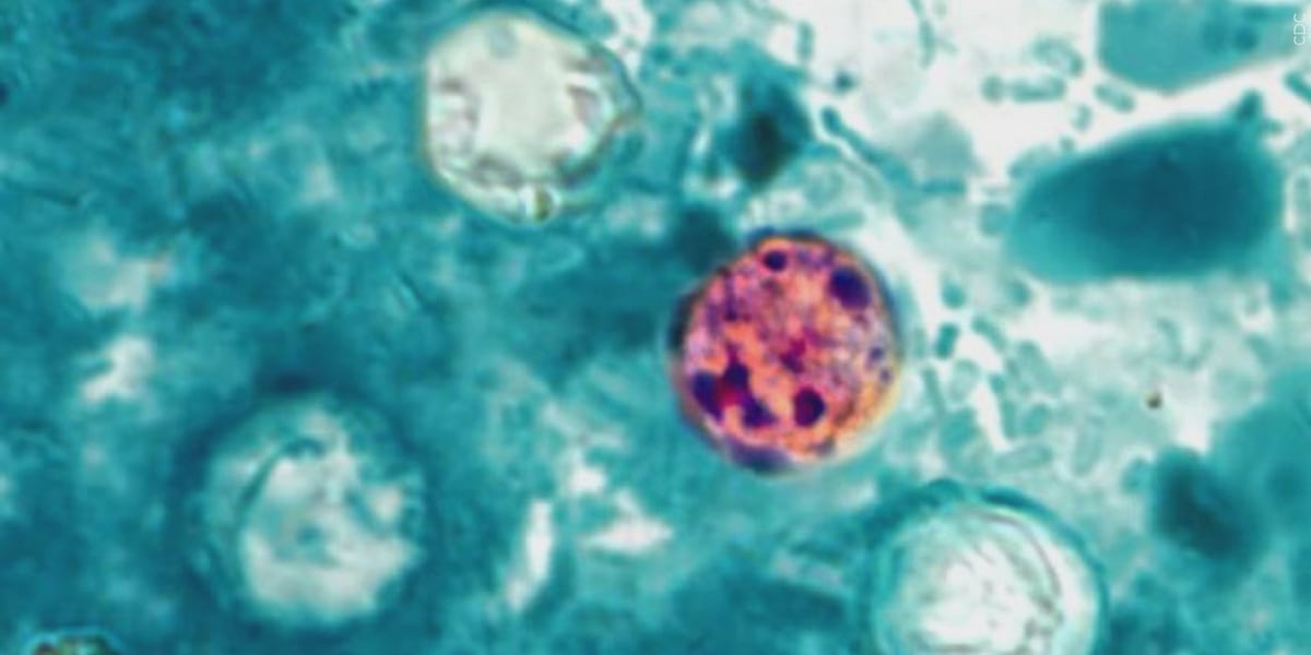 Reported cases of cyclosporiasis rise to 572 in Michigan